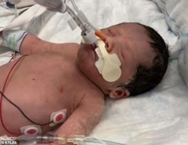 Adalyn Rose was delivered by emergency cesarean section after the accident. The newborn is fighting to survive and being monitored for brain damage at UC Irvine Medical Center
