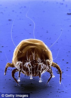 Unwelcome guests: Dust mites can live in your duvet and pillows