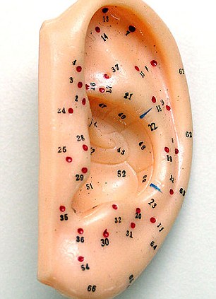 The acupressure points of the ear: Each one relates to a different part of the body