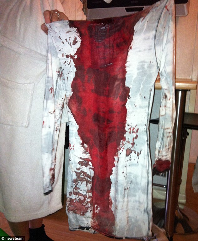 Bloodbath: The blood-stained dress of glassing victim Nicole Hill shows just how serious the wounds to her head were following the attack