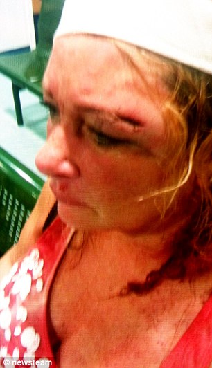 Glassing victim Lorraine Hill
