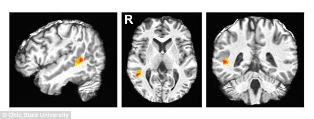 Researchers have pinpointed the region of the brain where facial expressions are decoded. Functional MRI scans showed activity in the posterior superior temporal sulcus (pSTS) region of the brain of a test subject (red and yellow region) who is recognising a facial expression