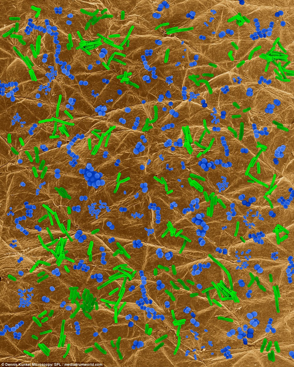 SKIN - GOOD BACTERIA: An SEM showing a photo-composite of 10 different types of bacteria on human skin. Recently studies have shown that over 120 different types of bacteria can occur in the microbiota of the human skin