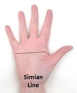 Simian-Line