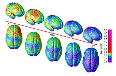 brain scan of teenage brain