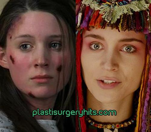 Rooney Mara Plastic Surgery Before and After